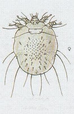 Klepítkatci - Pavoukovci - Roztoči - Zákožka svrabová